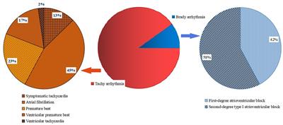 Analysis of risk factors and short-term prognostic factors of arrhythmia in patients infected with mild/moderate SARS-CoV-2 Omicron variant